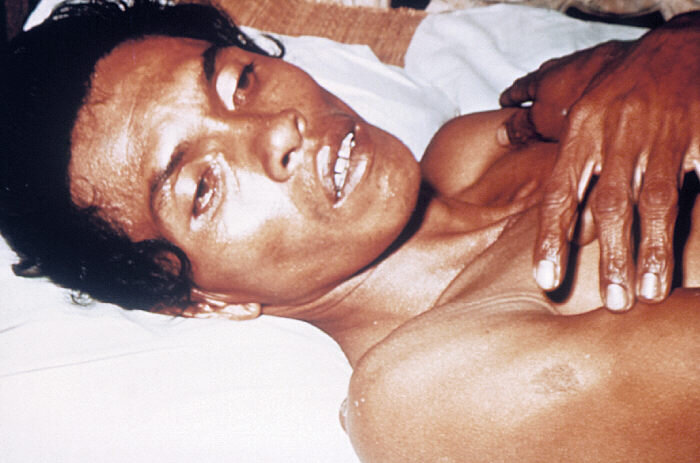 Cholera Outbreaks and the Birth of Modern Epidemiology